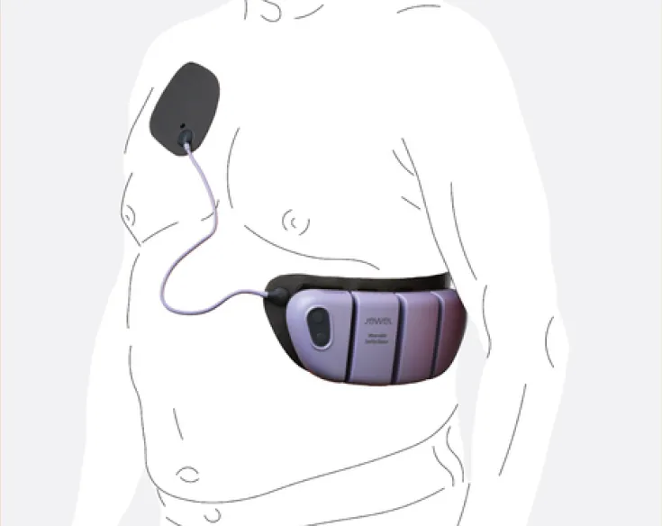 Jewel Illustration An illustration of the Jewel Patch on a patient