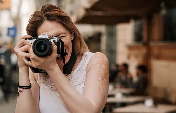 A woman with vitiligo on her arm taking a picture with a camera.